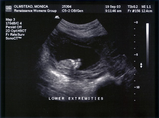 Baby Mojo